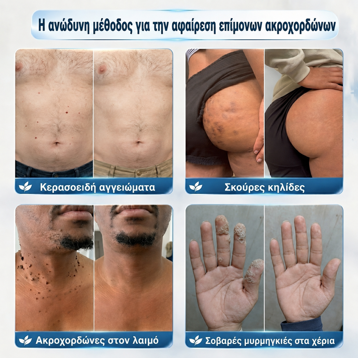 𝑻𝒓𝒊𝒍𝒖𝒎𝒊𝒂® 💎 Premium Στυλό Roller | Αφαίρεση για Μυρμηγκιές, Ελιές & Κηλίδες 🇬🇷