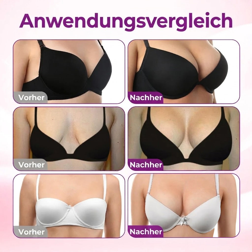 DE🔥Turonu® Fortschrittliches Nano-Microneedle-Pflaster zur gezielten Brustvergrößerung