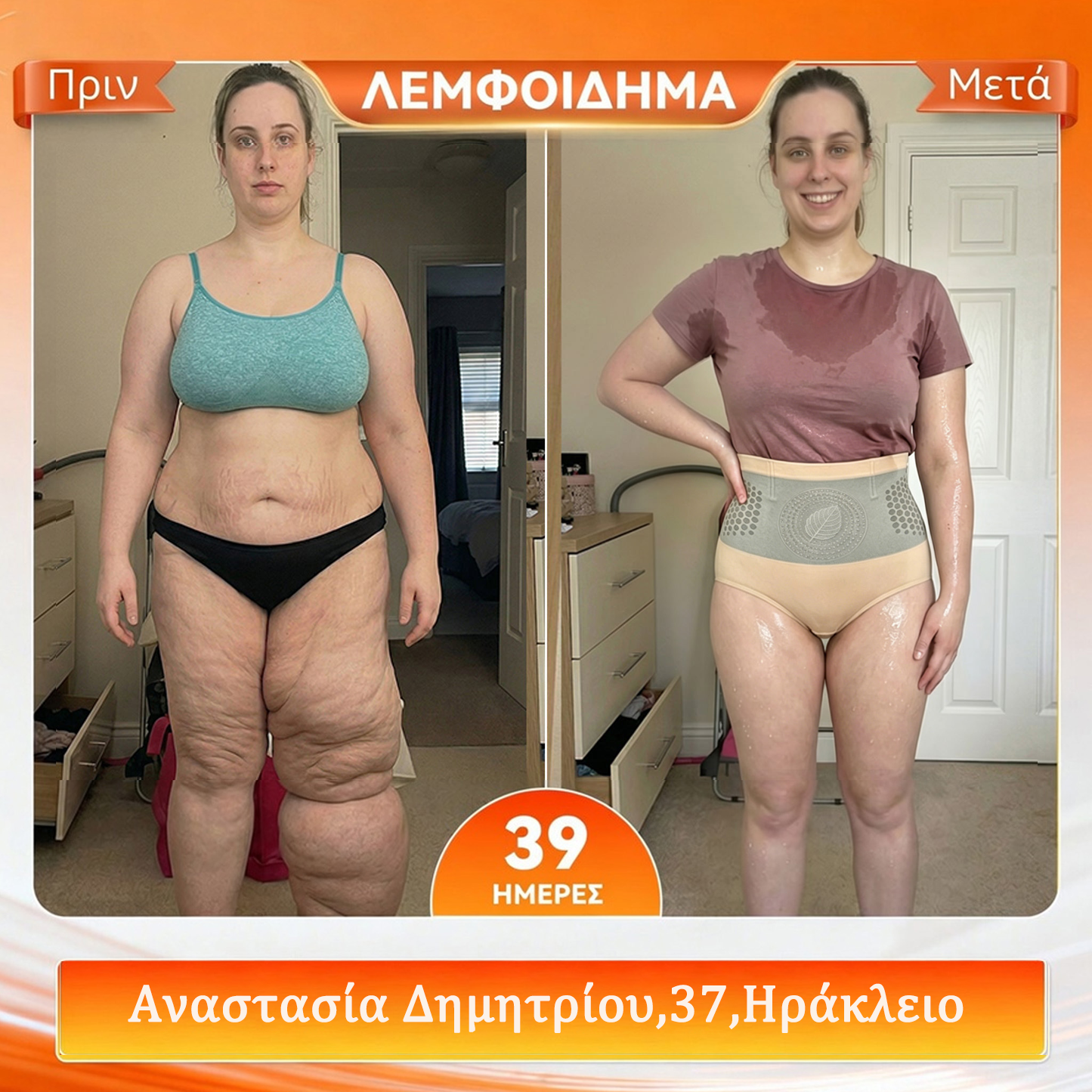 🇬🇷 Επίσημο Κατάστημα Μάρκας | 🐨 BQODQO® 💌 Μοριακή & Βερβερίνη 4-σε-1 Μικροσωματιδιακό Σορτσάκι Σχηματισμού Σώματος και Καύσης Λίπους 2026🧪🧪